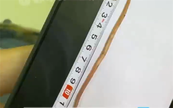 星欧平台：11岁男孩感染寄生虫瘦到15公斤：治疗排出一条13厘米长蛔虫